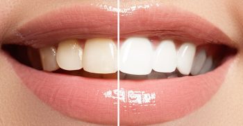 Cosmetic Dentistry